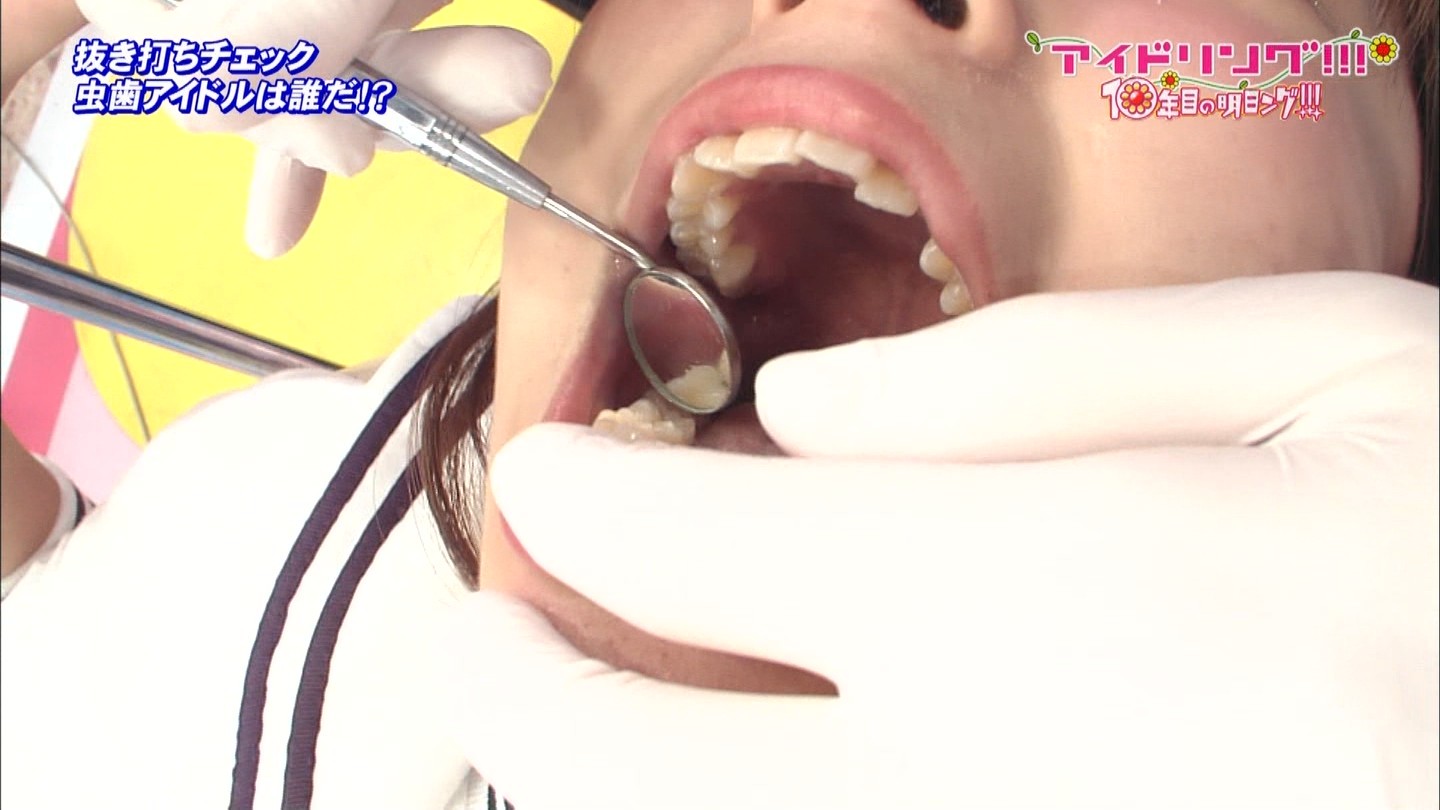 アイドリング虫歯 (5)