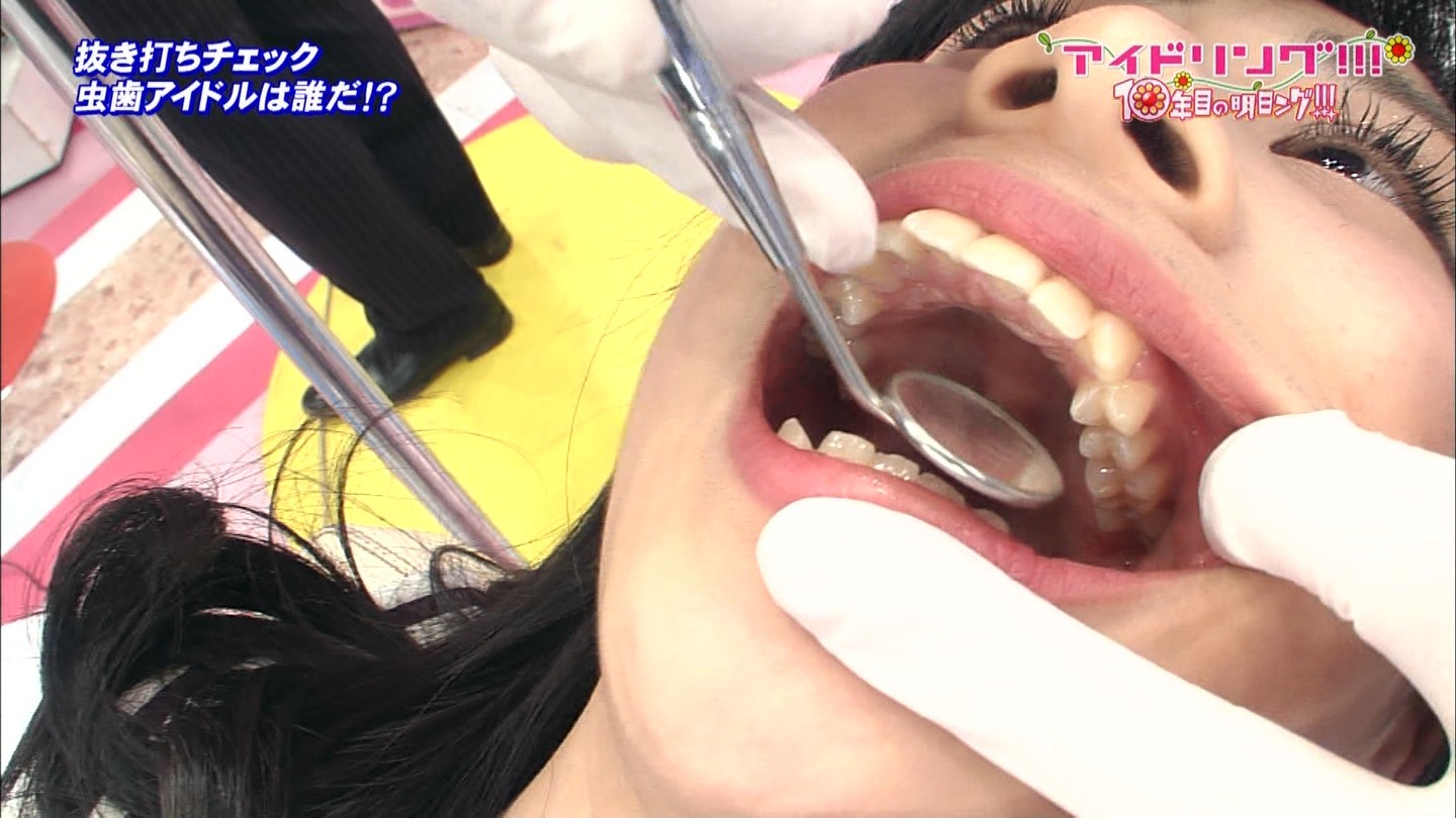 アイドリング虫歯 (12)