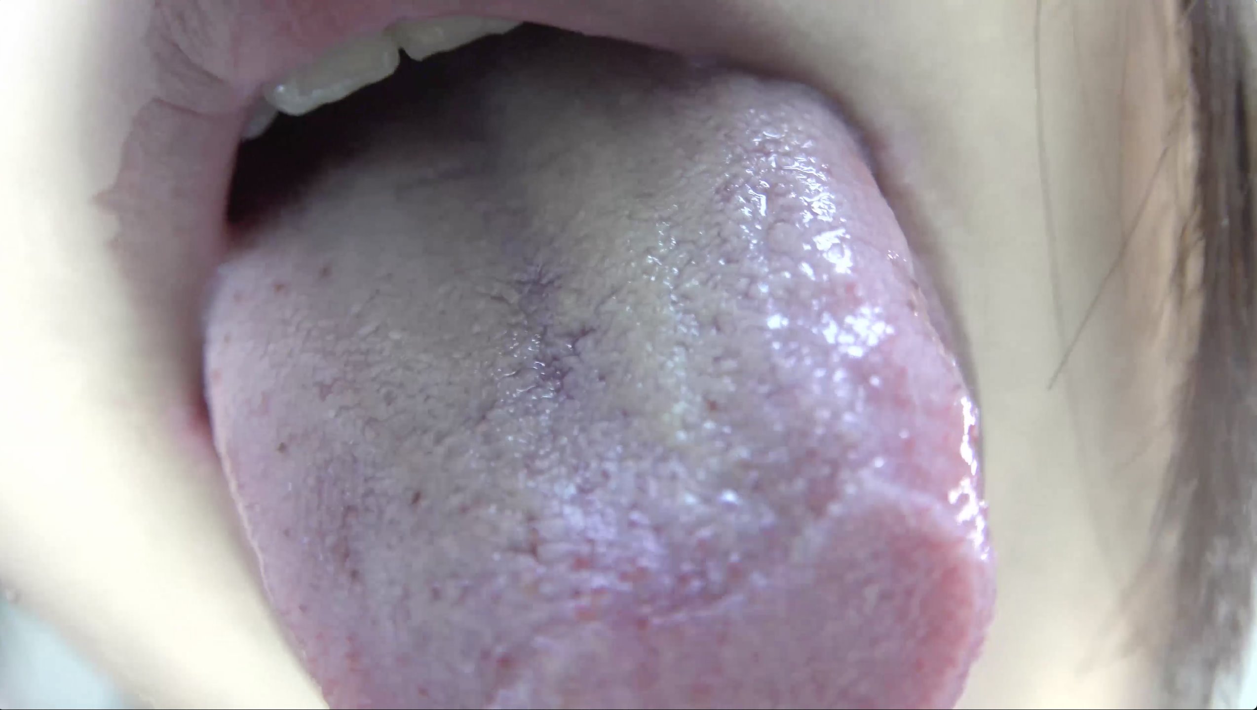 瀬菜ちゃんの天然大量舌苔のエロ白い舌ベロシリーズ (3)