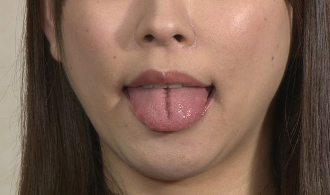 舌モデルの割れ舌 (2)